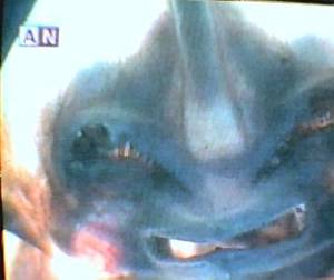 Extraño ser embalsamado